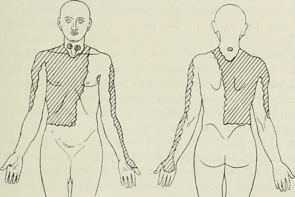 레이저토닝 부작용 색소침착 막는 5단계 관리법 관련 피부과 진료 (참고 이미지)